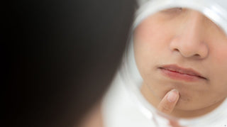 Akne vs. rosacea: sådan kender du forskel og undgår at smadre din hudbarriere