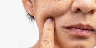 Creme-til-løs-hud-sådan-strammer-du-huden-naturligt-og-effektivt skinfulness.dk
