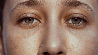 Ser du altid træt ud? Sådan vinder du kampen mod mørke rande under øjnene